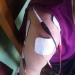 Borges Fisioterapia Itaí SP 003